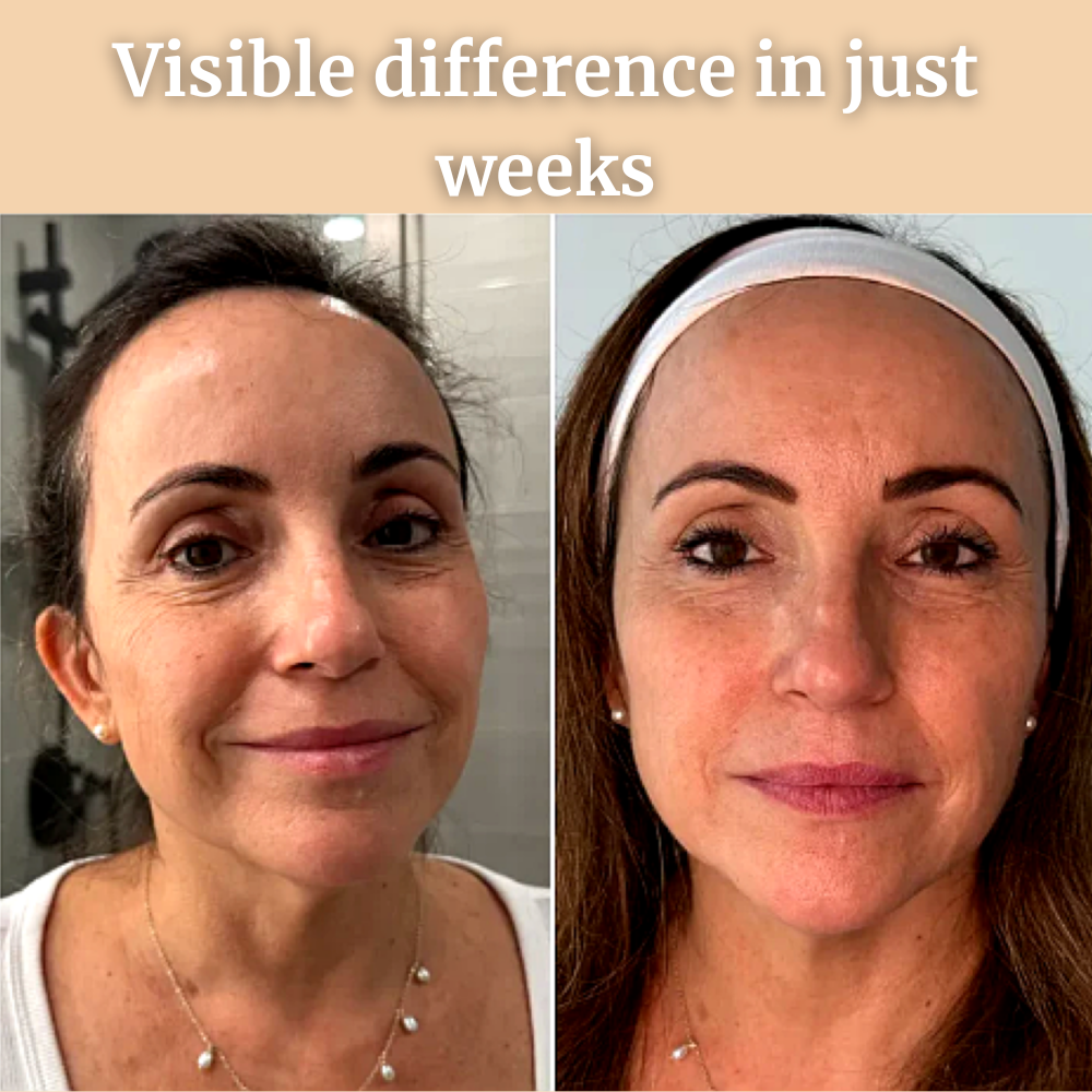 Classy Drops VelvetSkin Pro®