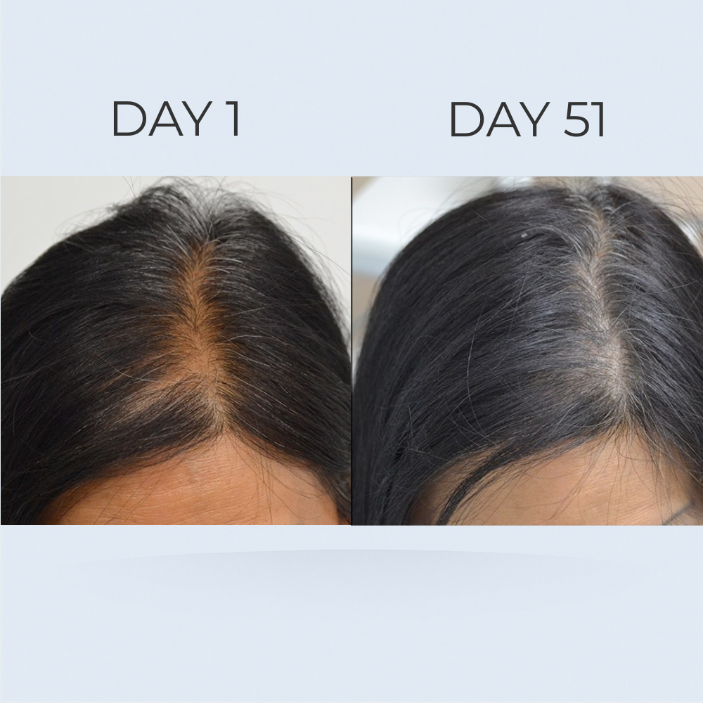 GrowGleam Roll-On Serum