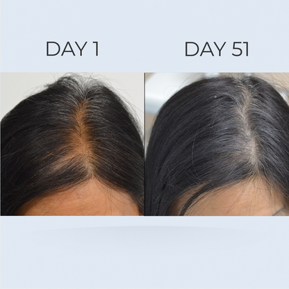 GrowGleam Roll-On Serum