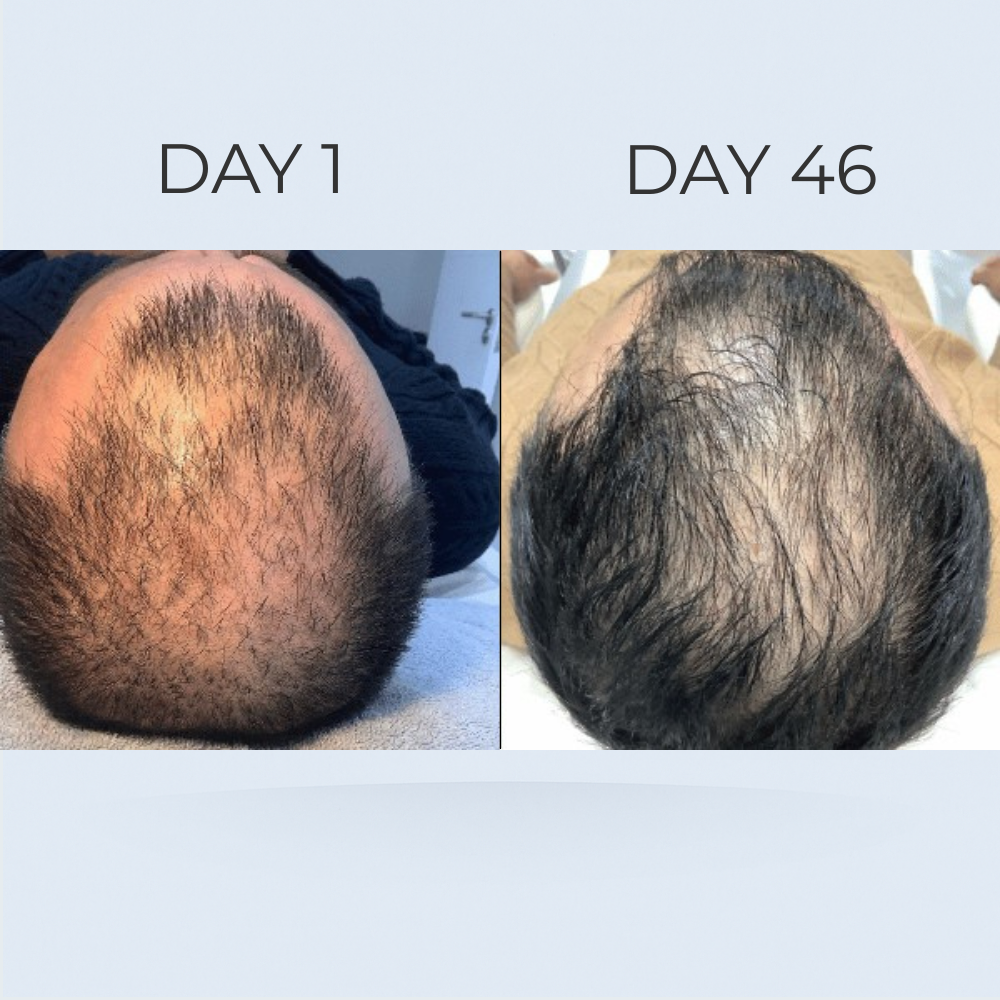 GrowGleam Roll-On Serum