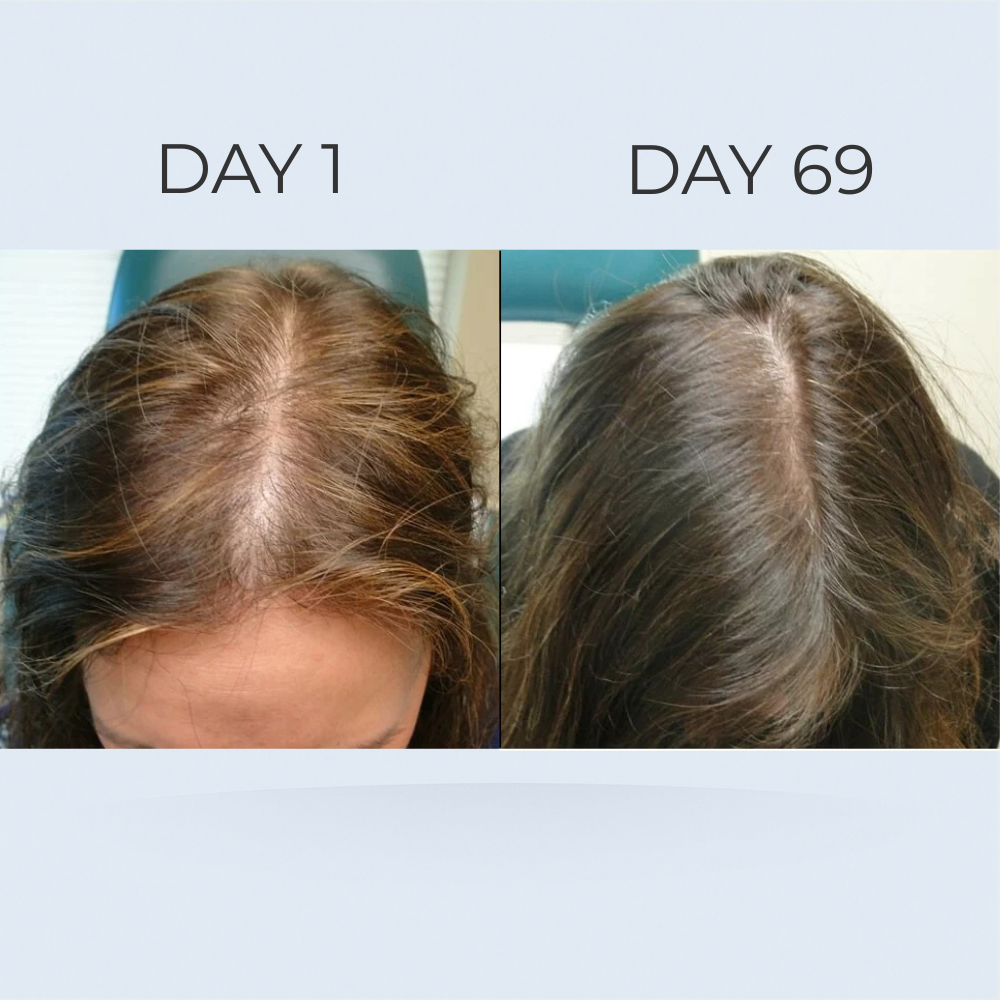 GrowGleam Roll-On Serum