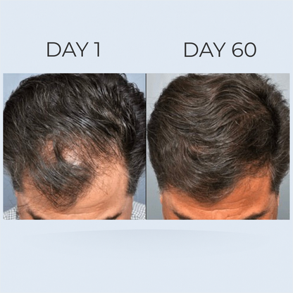 GrowGleam Roll-On Serum